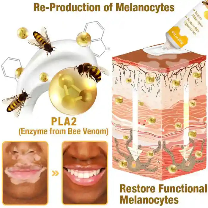 New Revitalizing Bee Venom Cream Natural Skin Restoration. Buy 1 - Get 2 Free. Pay only ₹599 (Save ₹900) Regular priceRs. 1,799.00 INR Sale priceRs. 599.00 INRSale